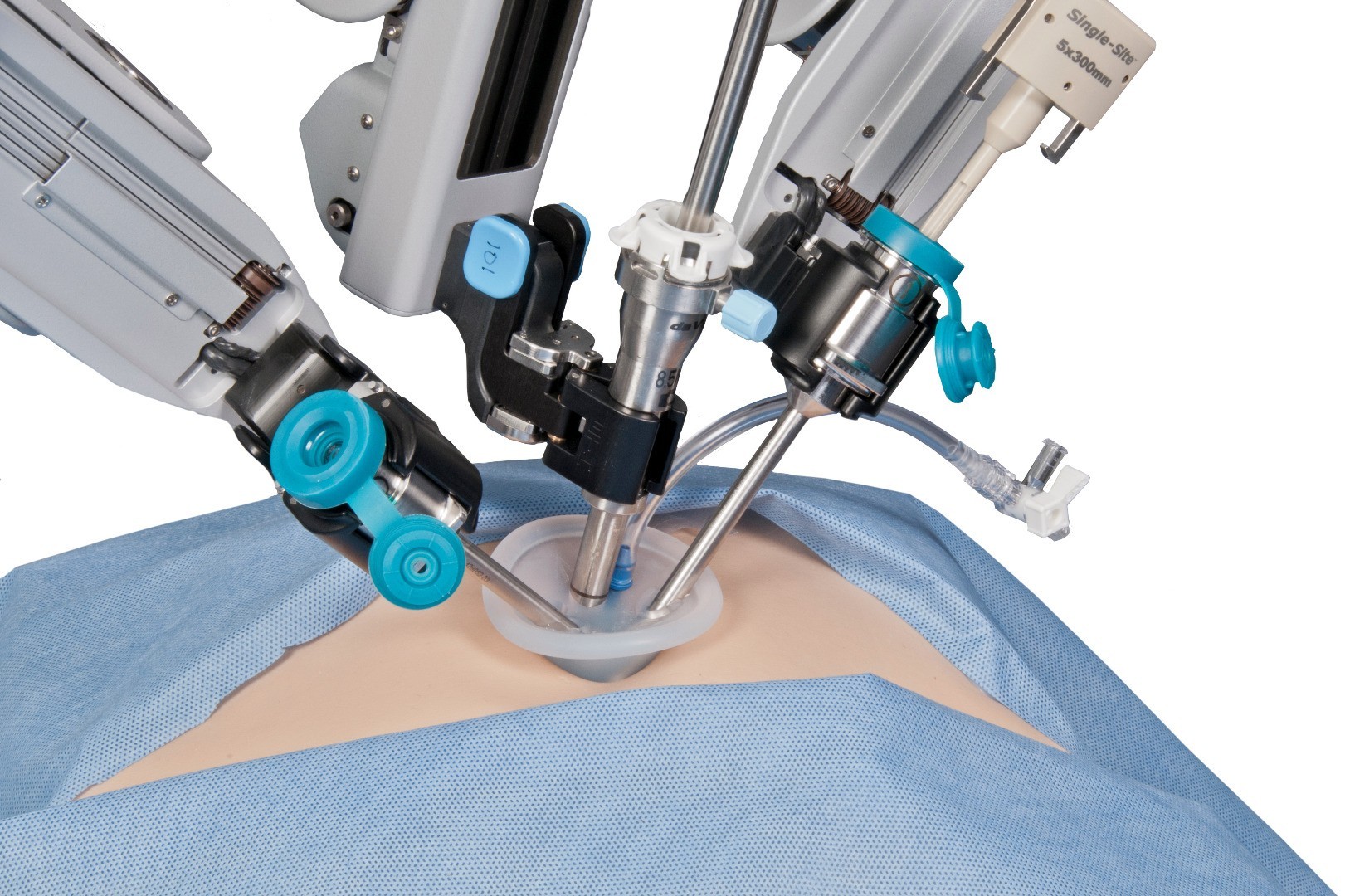 После простатэктомии форум. Робот DAVINCI операция лапароскопическая. Робот да Винчи операции. Da Vinci робот-хирург. Робот да Винчи консоль хирурга.